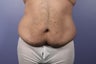 37 yr old male weight loss patient