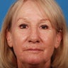 60 - 70 Year Old Female