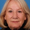 60 - 70 Year Old Female