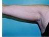 34 year old female patient