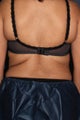 CoolSculpting