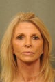 67 Year Old Female Treated for Volume Loss