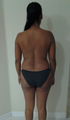 4 weeks after surgery. Liposuction + fat transfer to butt (Brazilian Butt Lift)