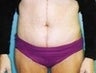 33 year old female patient