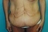 33 year old female patient