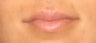 Lip Enhancement