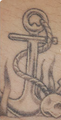 Tattoo Removal Before & After