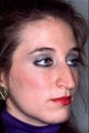 Rhinoplasty for a long nose