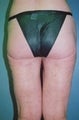 61 year old female patient