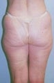 61 year old female patient