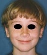 9 year old male patient