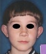 9 year old male patient
