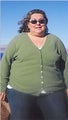 Female Gastric Bypass Patient Lost 175 lb