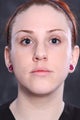 Photofacial
