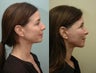 Facial Reconstructive Surgery