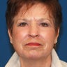 60 - 70 Year Old Female