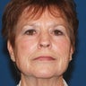 60 - 70 Year Old Female
