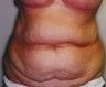 62 year old female patient