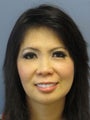 Chin Surgery on 32-year-old