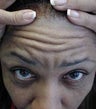 Female Botox Patient