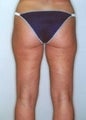 27 year old female patient