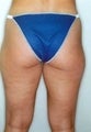 27 year old female patient