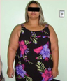 29 yr old female treated for severe obesity