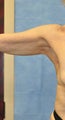 70 Year Old Female