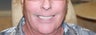 All-on-4 Dental Implants