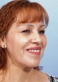 Female Chin/Neck Liposuction