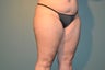 Cellulaze