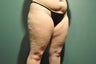 Cellulaze