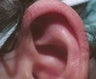 32 year old male patient