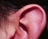 32 year old male patient