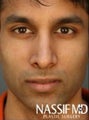 Indian Male Rhinoplasty