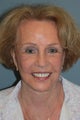 LiteLift™ on 82-year-old Woman