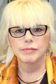 LiteLift™ and Platysmaplasty on 60-year-old Female