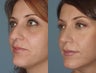 Female, Late 30's