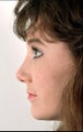 Rhinoplasty to make the face appear younger