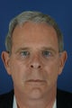 63 y.o. Male Liquid Facelift with Fillers