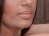 Lip Filler with Juvederm Volbella