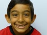 Childs otoplasty