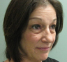 quadbleph "eyelid lift" with midface lift, botox and juvederm to forehead