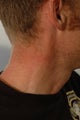 Neck Tattoo Removal -Laser Treatment