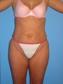 37 Year Old Female