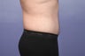 37 yr old male weight loss patient