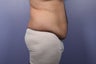 37 yr old male weight loss patient