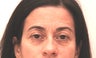 48 Year Old woman treated for forehead lines