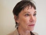 70 Year old Female - "Softlift" treatment (combination Juvederm & Botox)