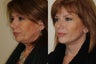 53 year old female